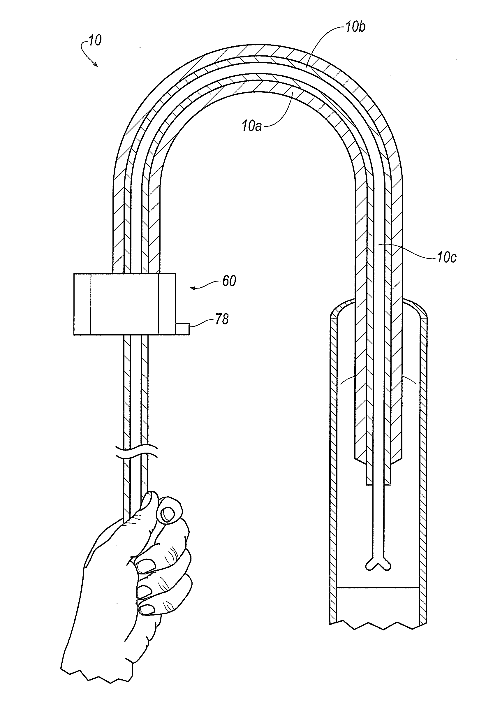 Devices for Superficial Femoral Artery Intervention