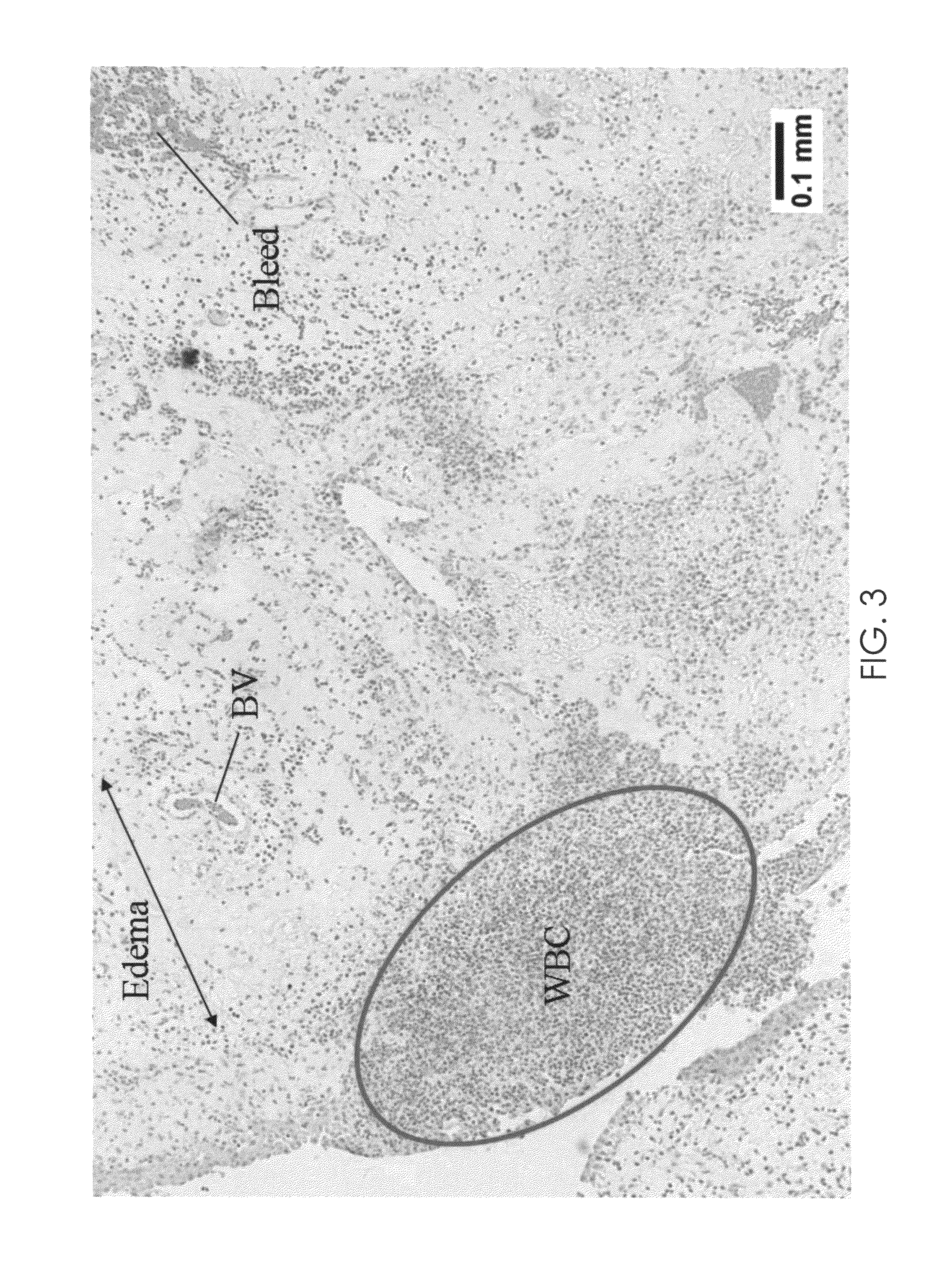 Pharmaceutical composition for treating urinary system disorders