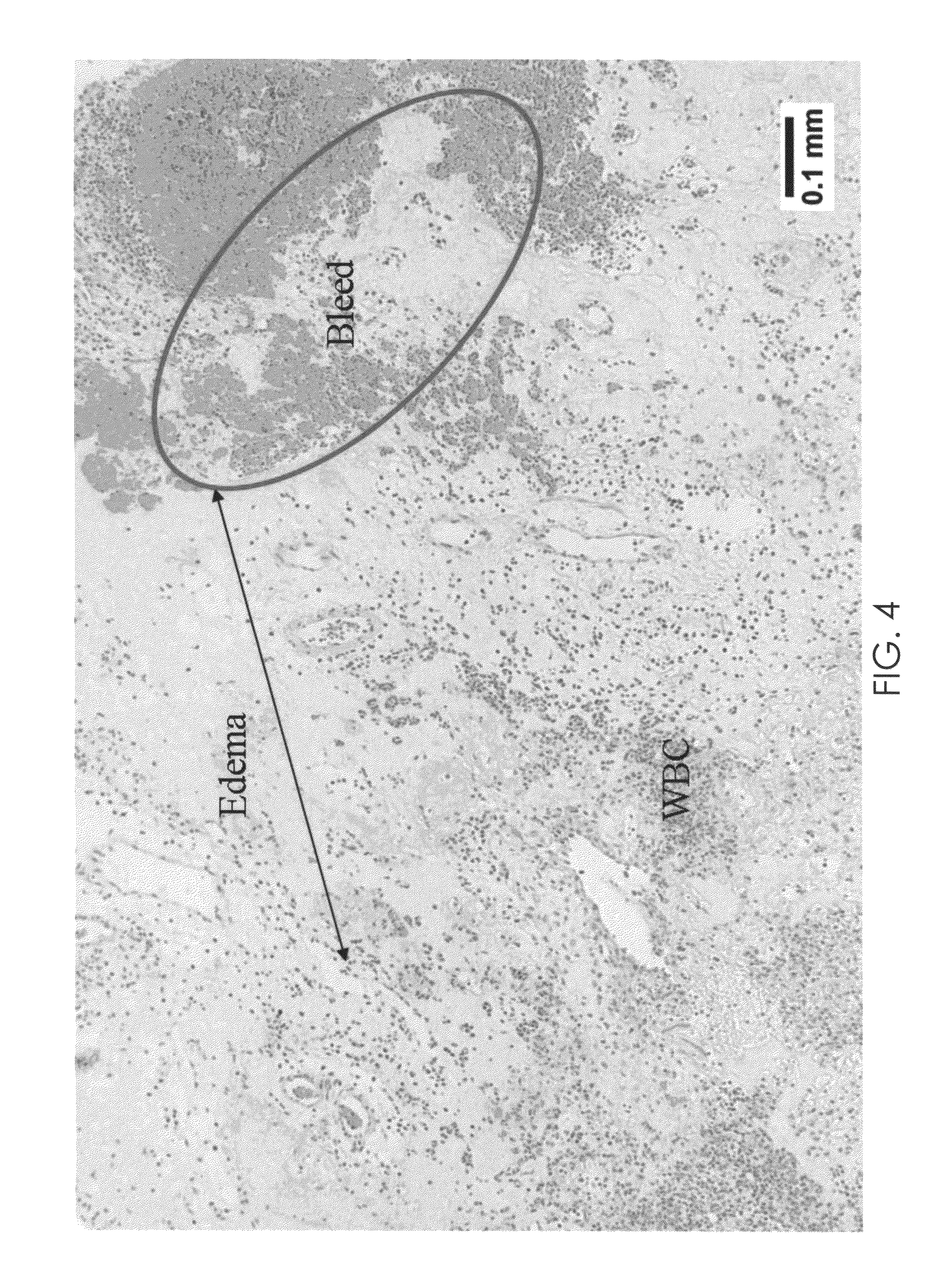 Pharmaceutical composition for treating urinary system disorders