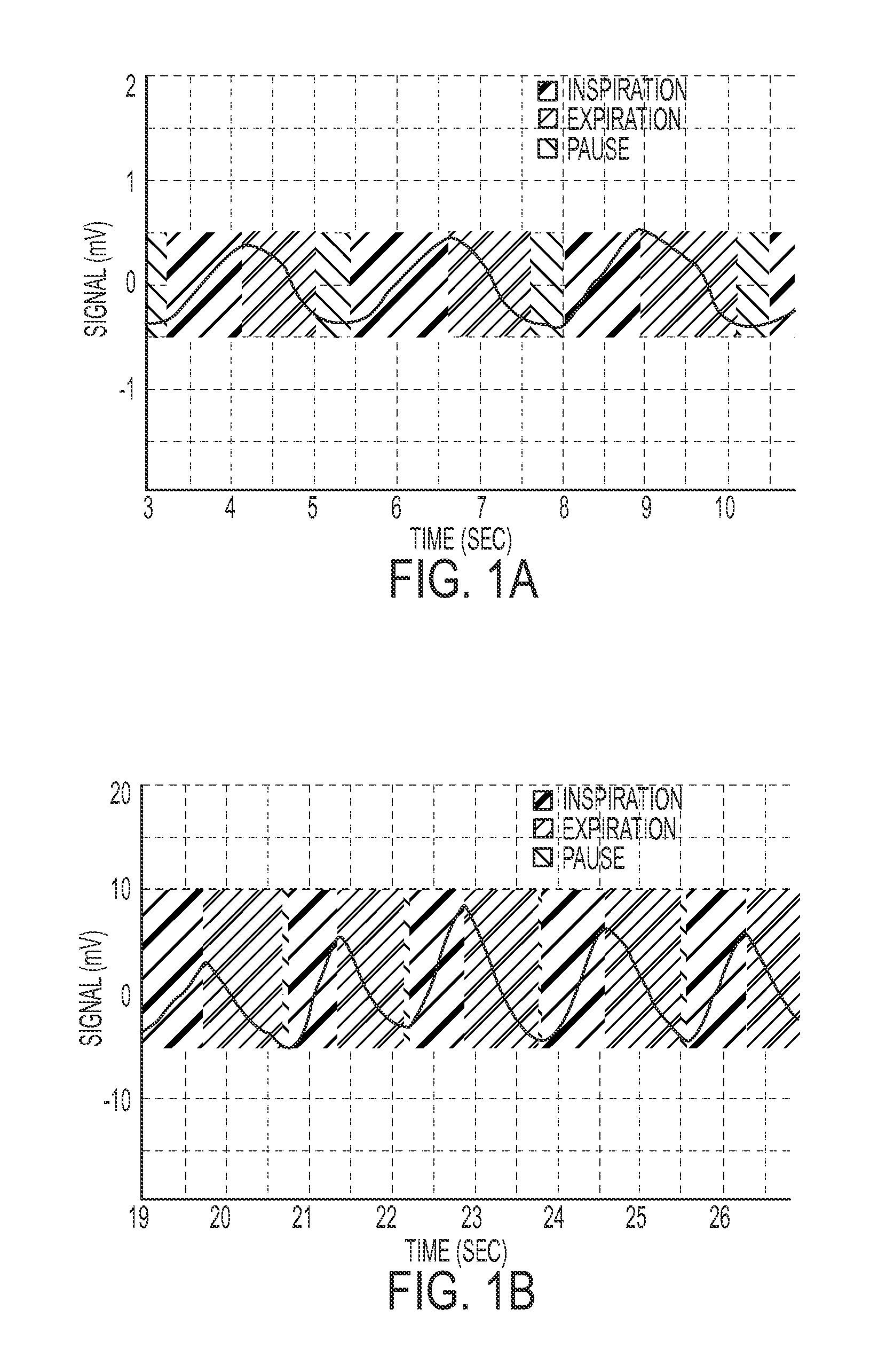 Monitoring respiration with a thermal imaging system