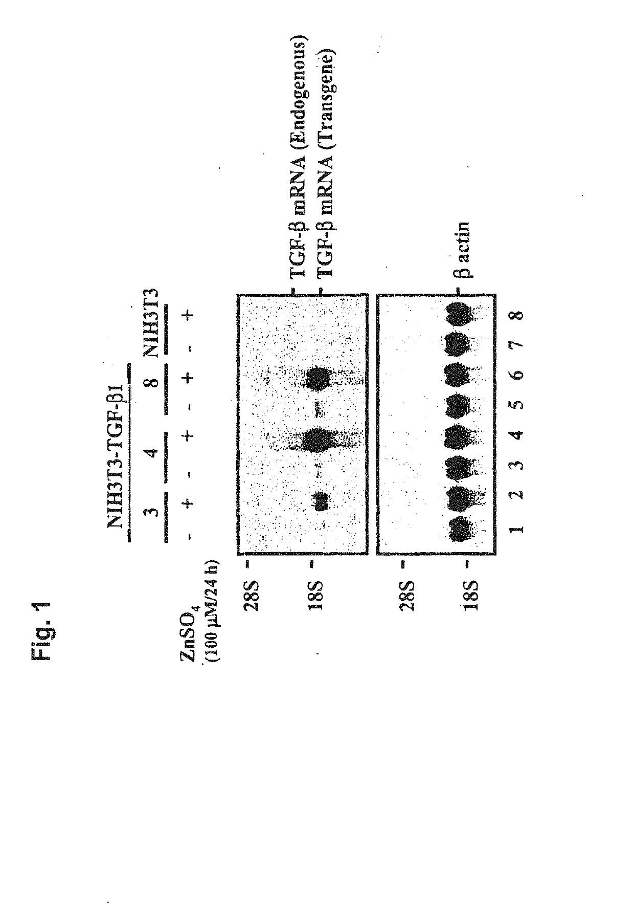 Cartilage regeneration using chondrocyte and tgf-beta