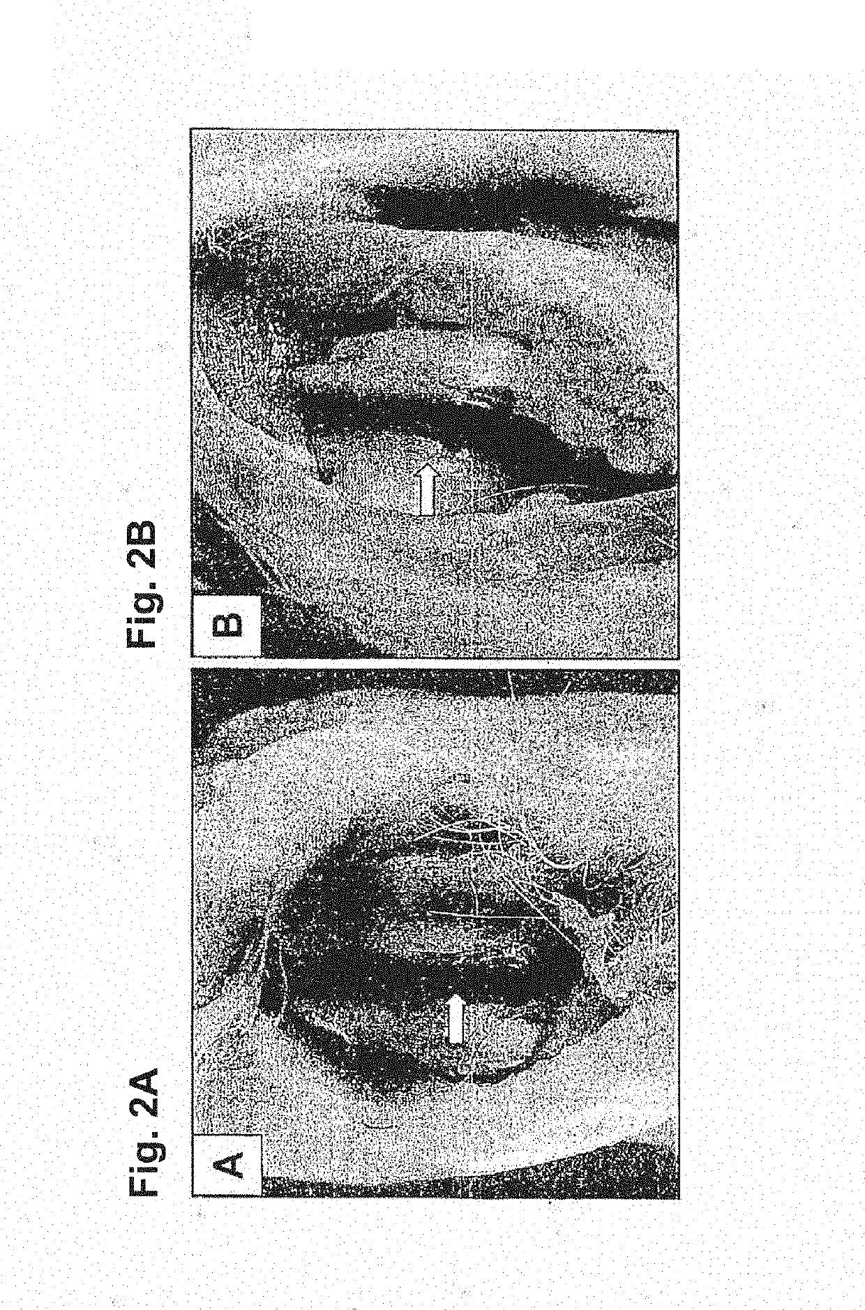 Cartilage regeneration using chondrocyte and tgf-beta