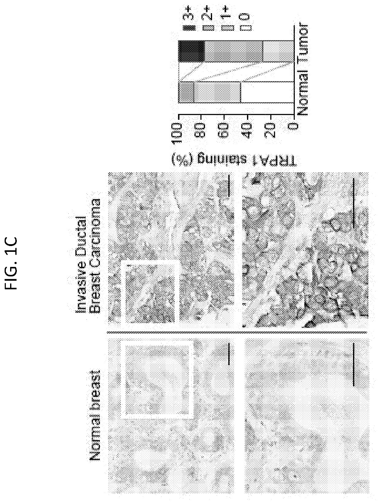 Methods of use for trp channel antagonist-based combination cancer therapies