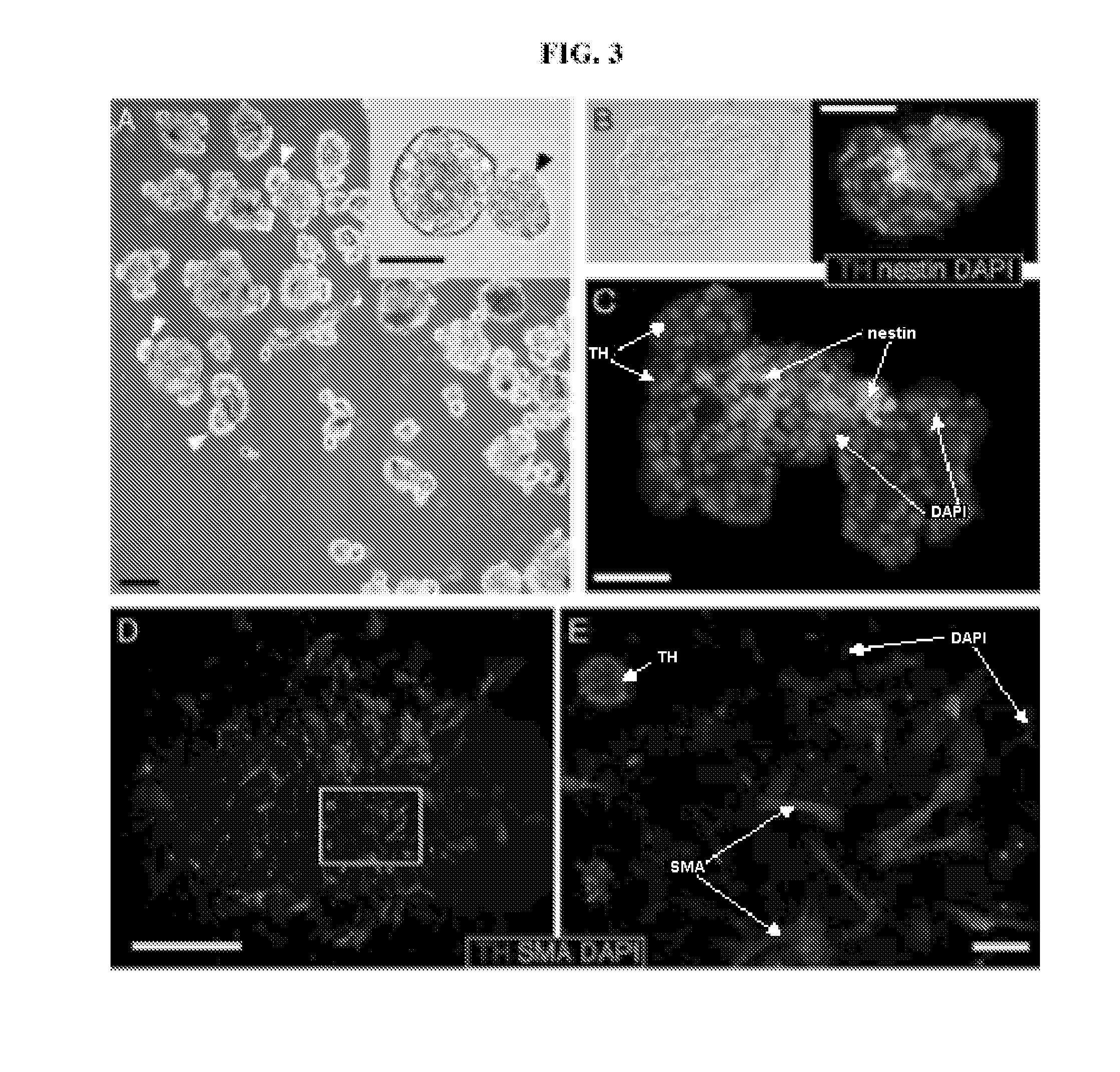 Stem cells derived from the carotid body and uses thereof