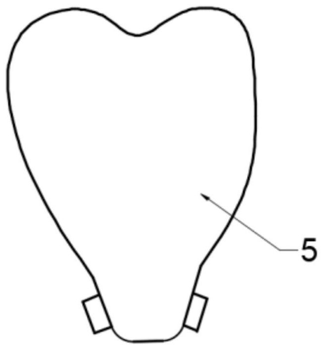 An osteoinductive dental implant