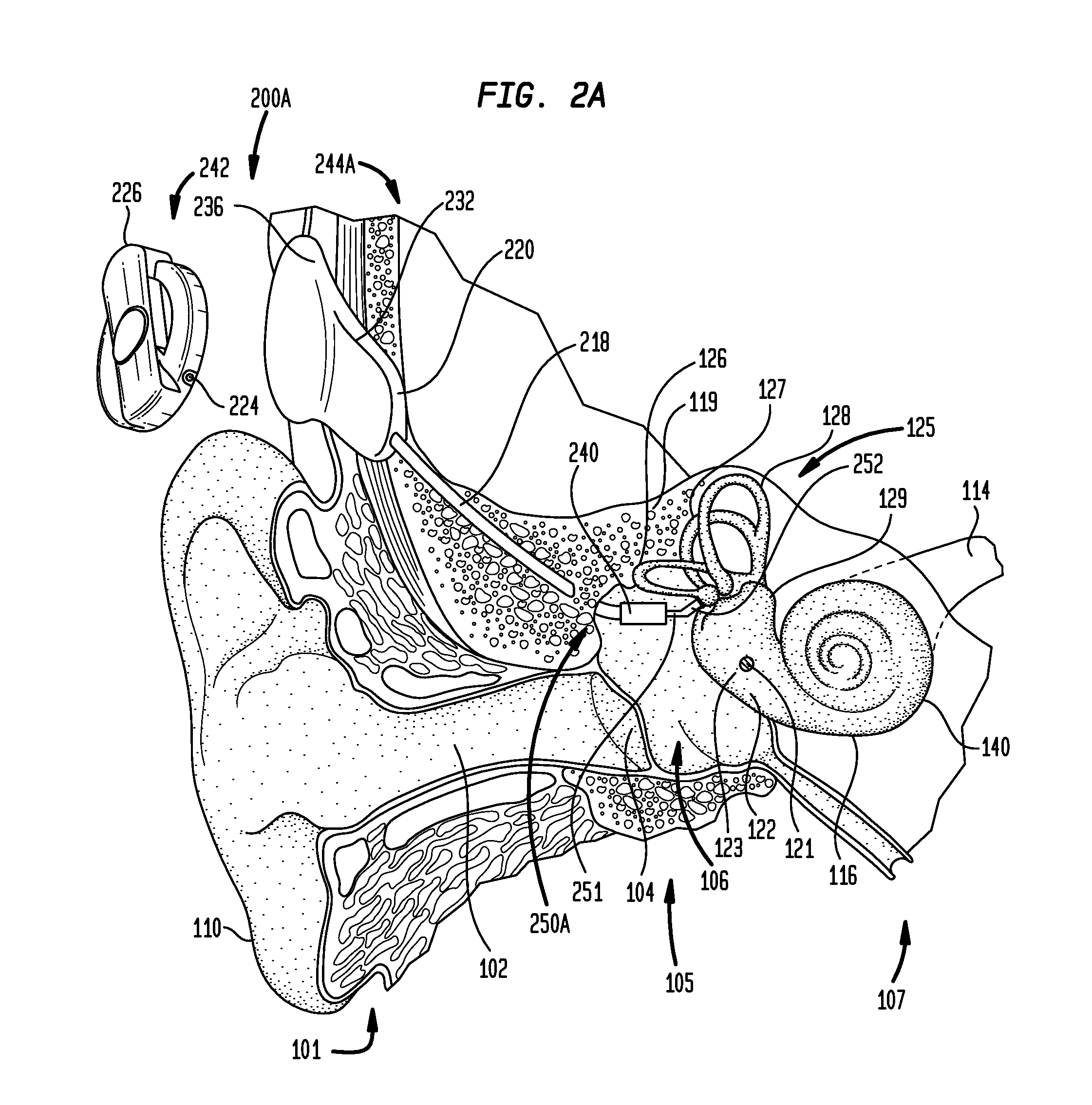 Identifying hearing prosthesis actuator resonance peak(s)