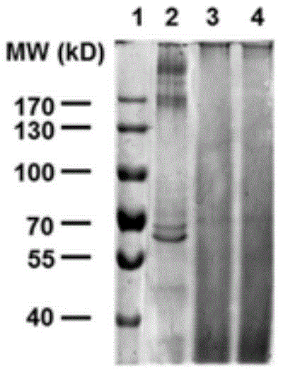 Sericin hydrogel, preparation method and application thereof