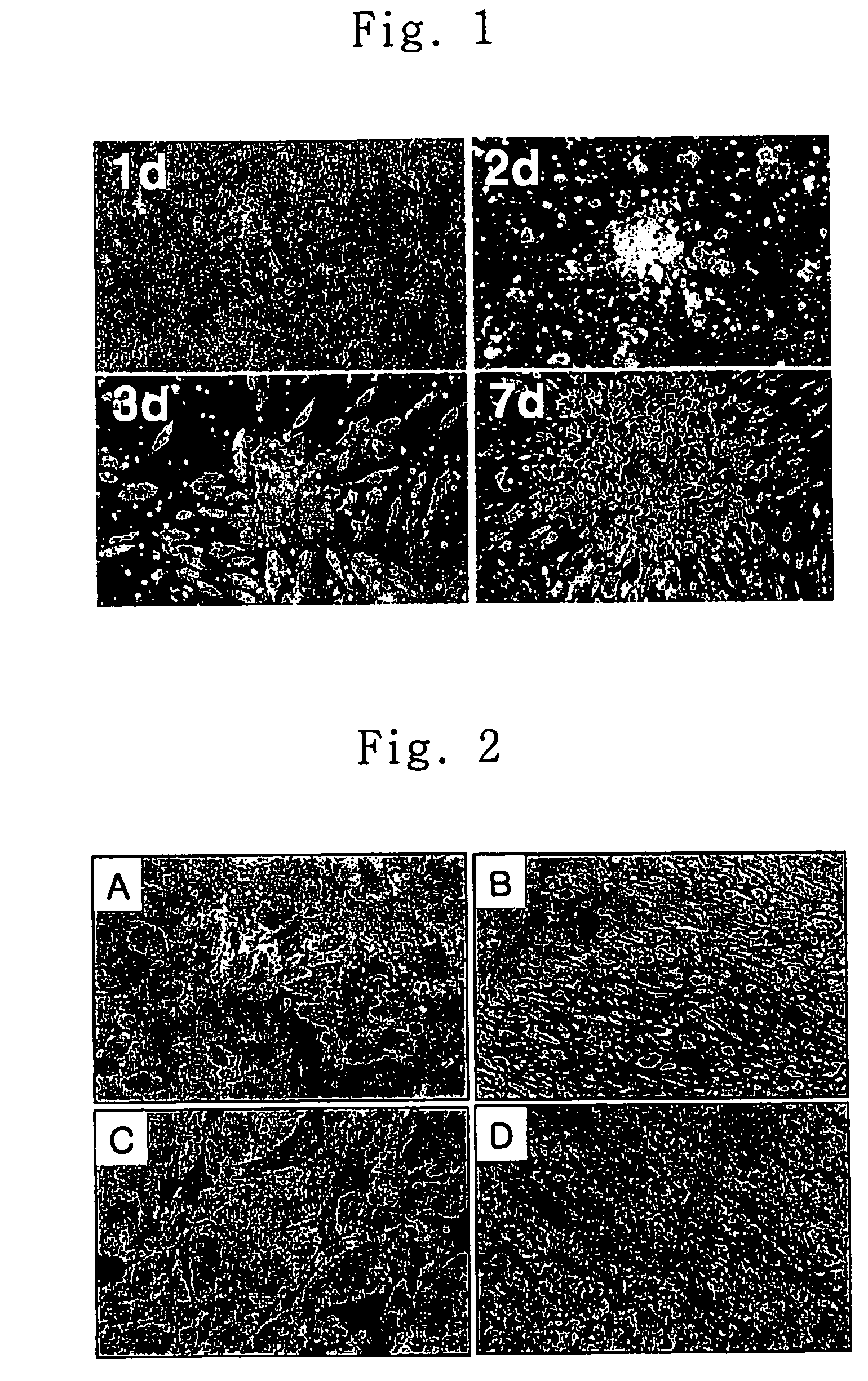 Method for transdifferentiating mesenchymal stem cells into neuronal cells