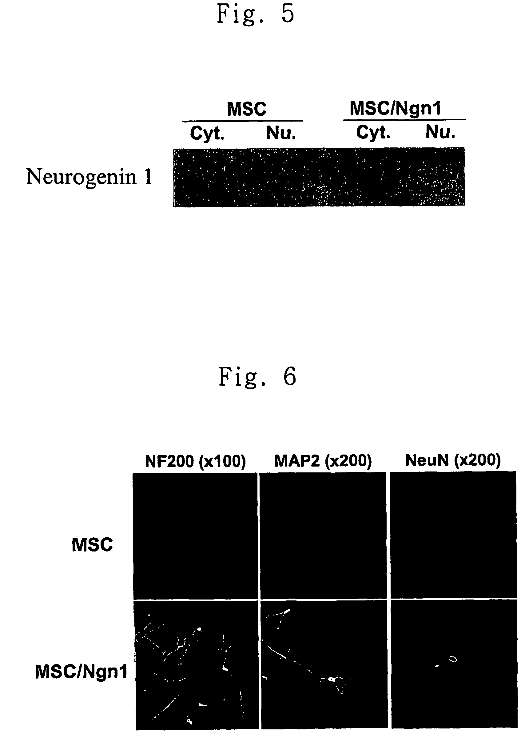 Method for transdifferentiating mesenchymal stem cells into neuronal cells