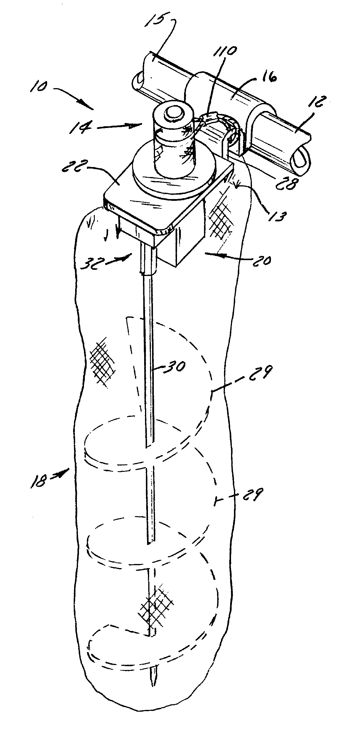 Ground Securing System