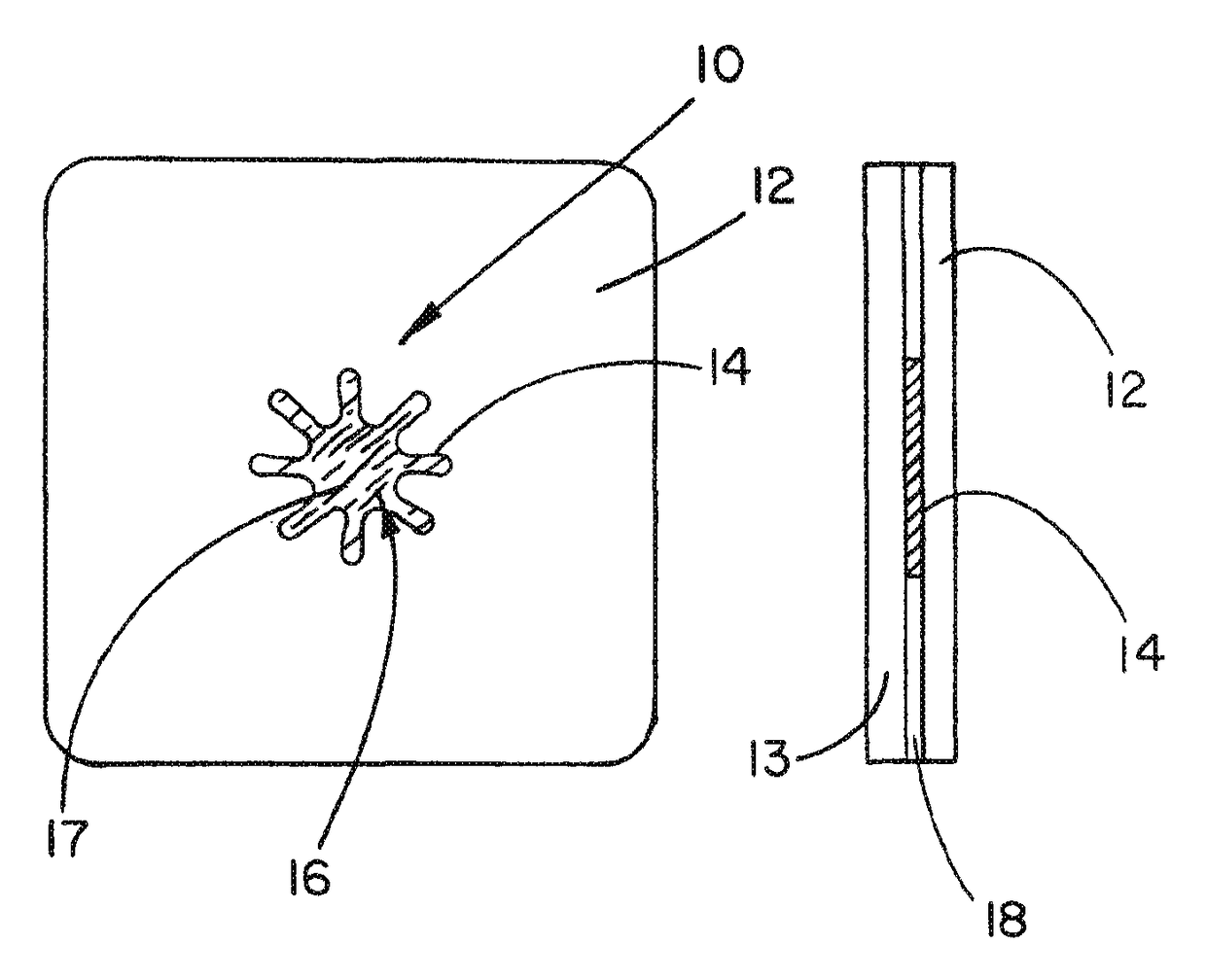 Medical device ameneable to fenestration