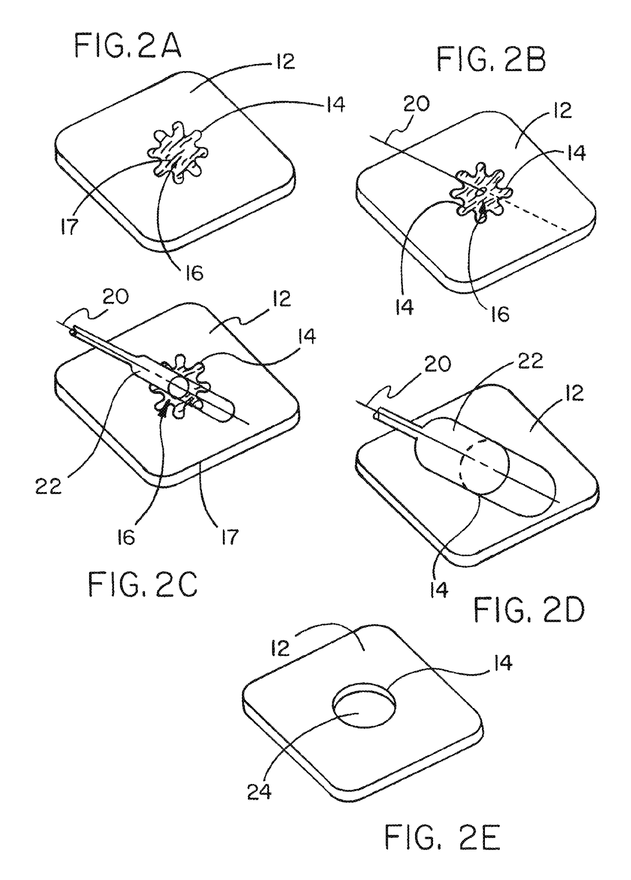 Medical device ameneable to fenestration