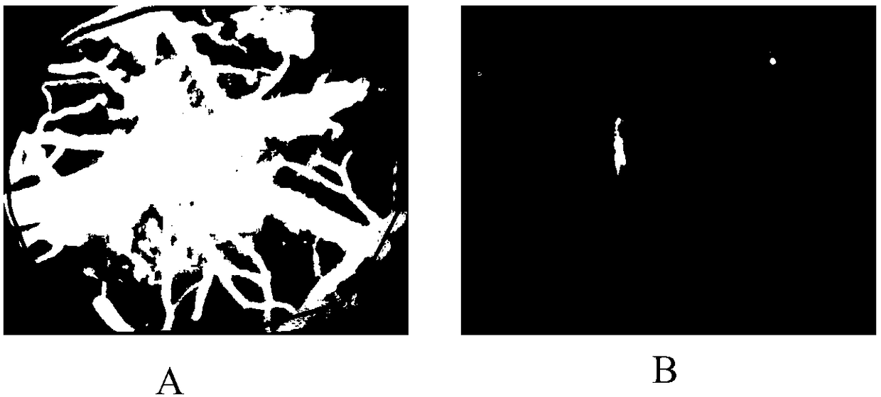 Nerve injury resisting method of ischemic brain injury animal model