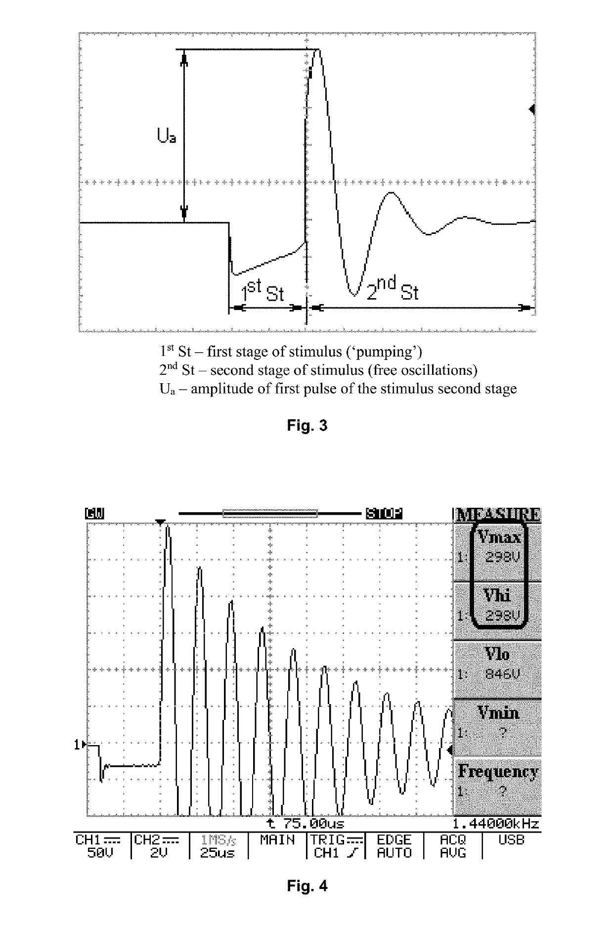 Method for identifying optimal regions for cardioversion therapy (variants)