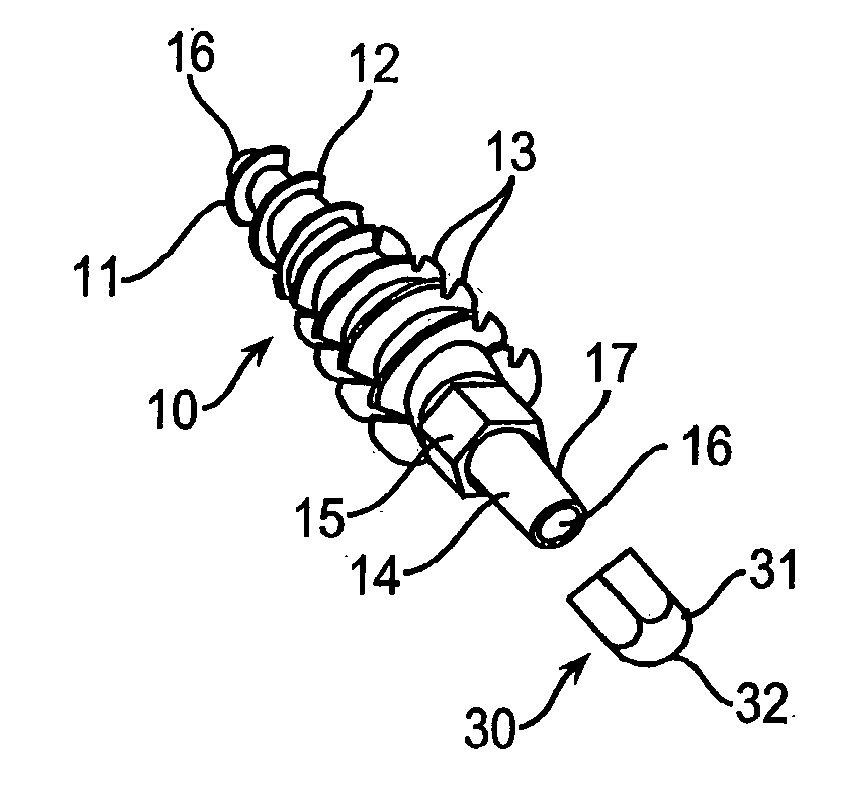 System and Method for Joint Resurface Repair