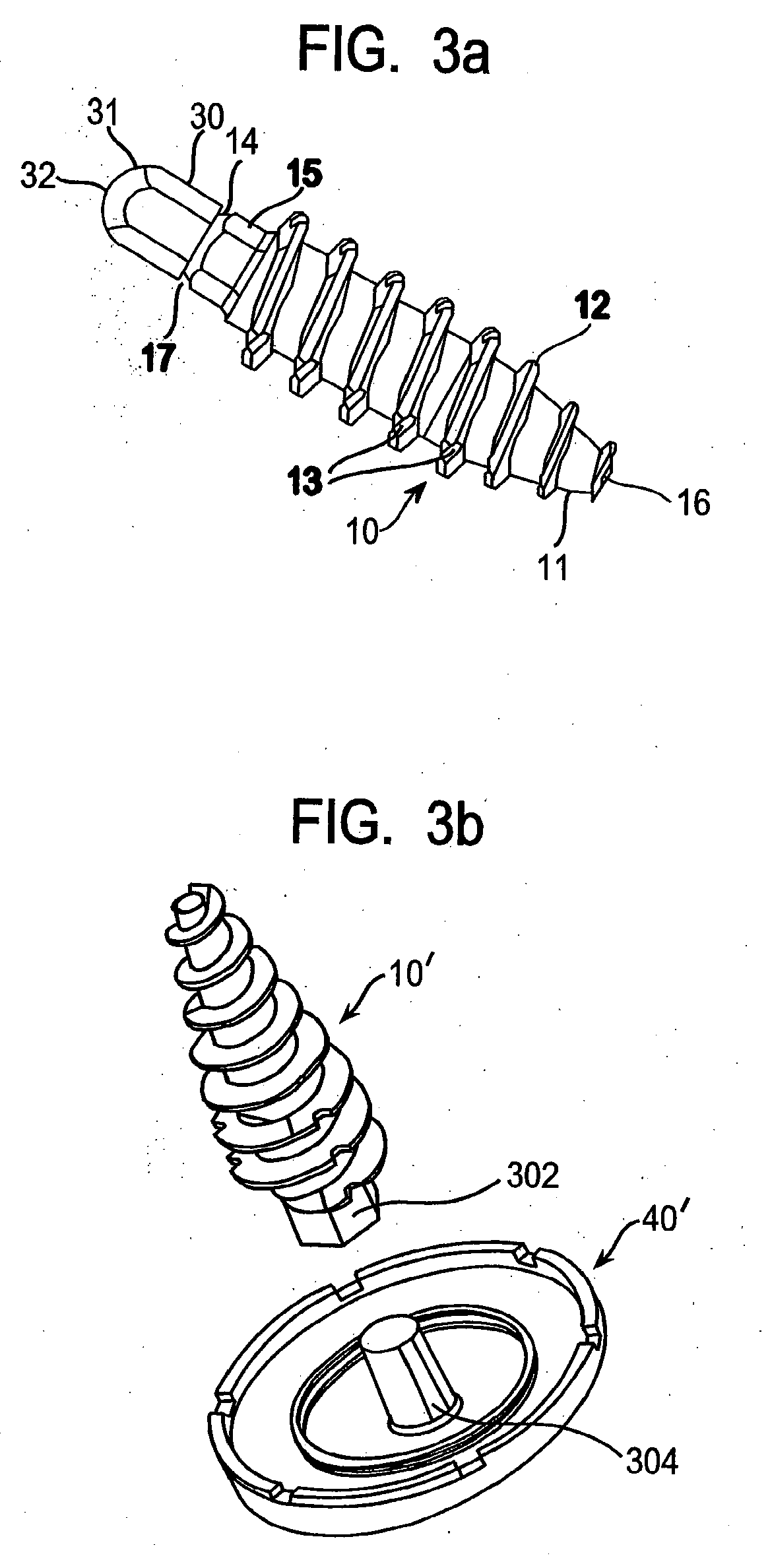 System and Method for Joint Resurface Repair