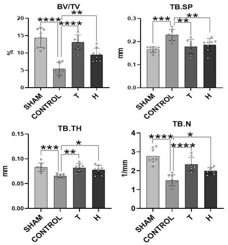 Application of higenamine hydrochloride in preparation of medicine for treating osteoporosis