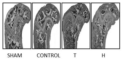 Application of higenamine hydrochloride in preparation of medicine for treating osteoporosis