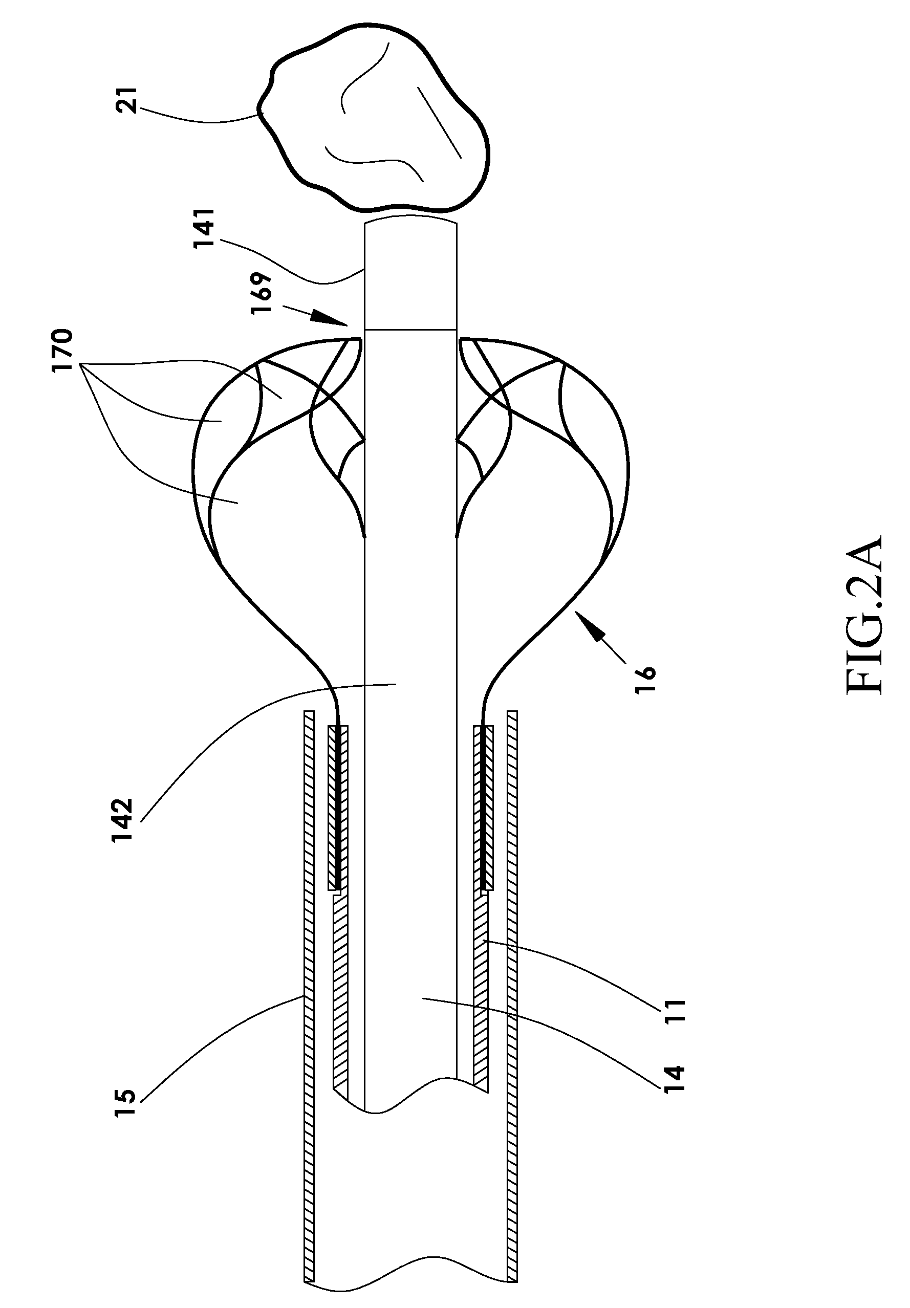 Device and method for fragmenting and removing concretions from body ducts and cavities