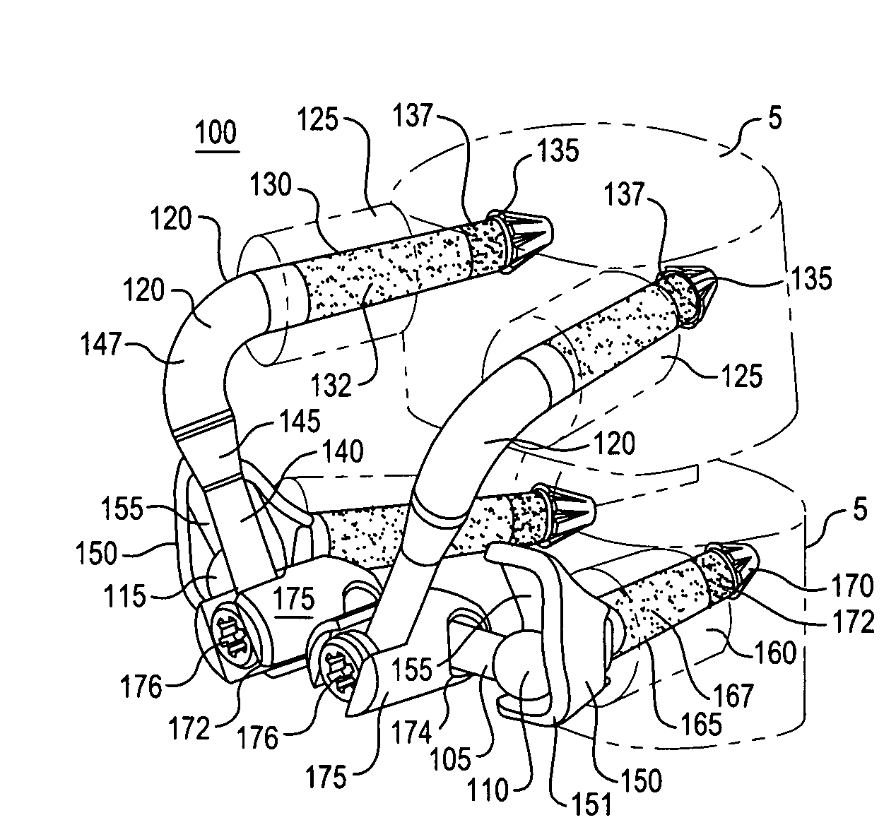 Crossbar spinal prosthesis having a modular design and related implantation methods