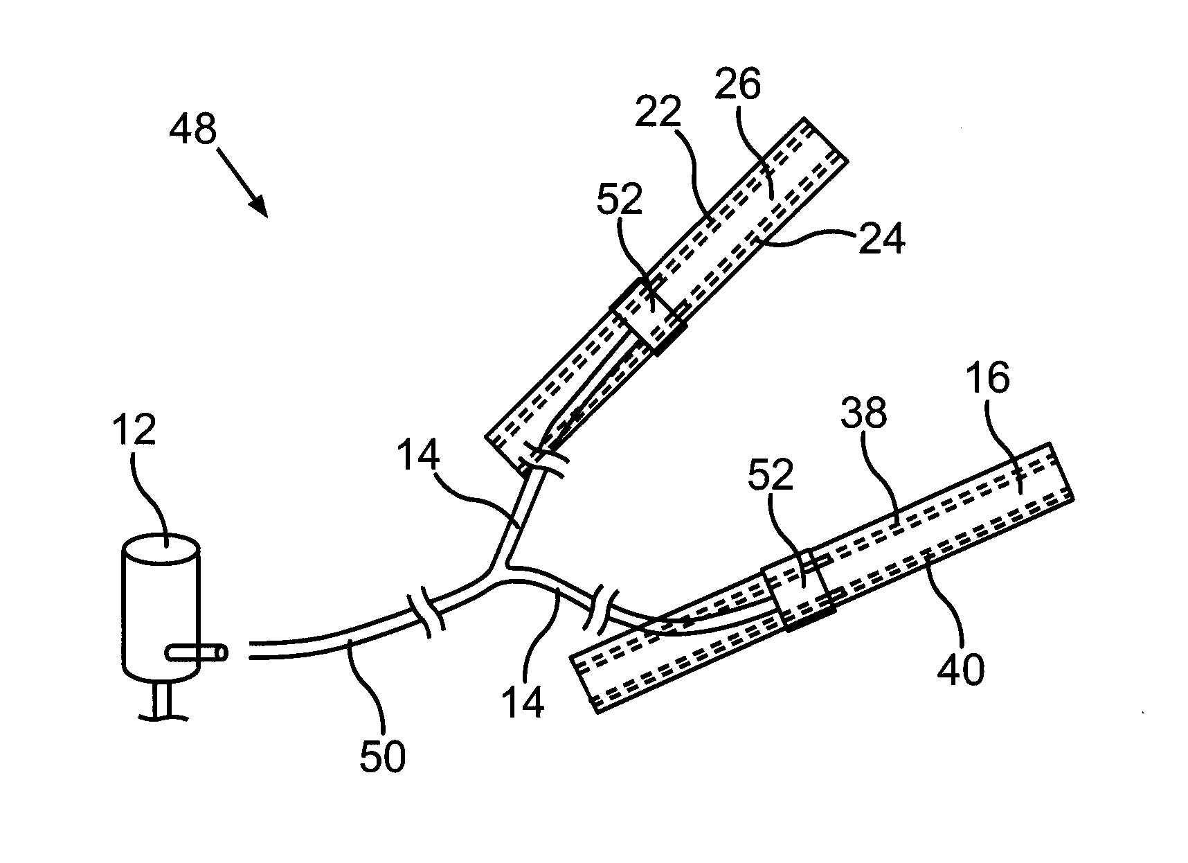 Wiper Arrangement and Method for Operating a Wiper Arrangement for a Motor Vehicle