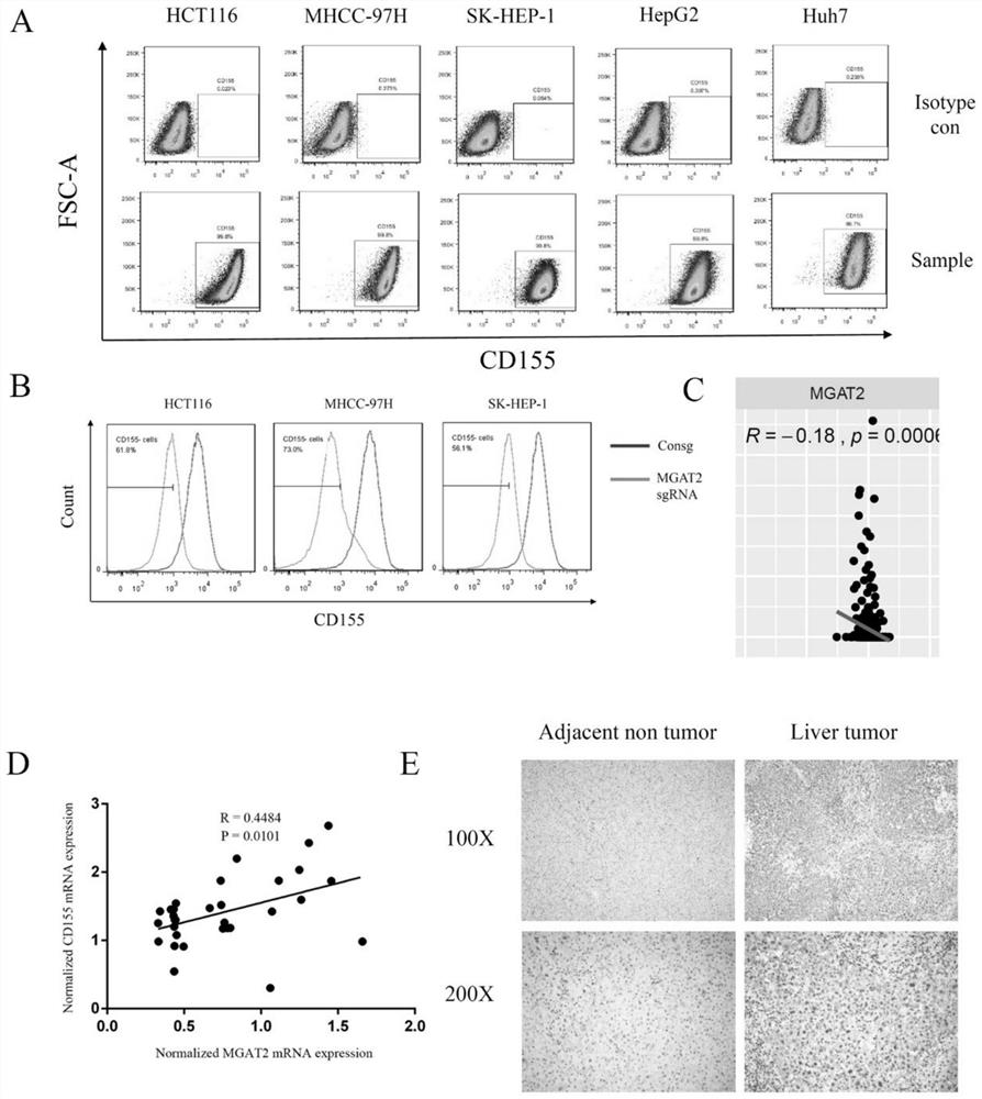 Application of GnT-II gene down-regulated expression as liver cancer prognostic marker