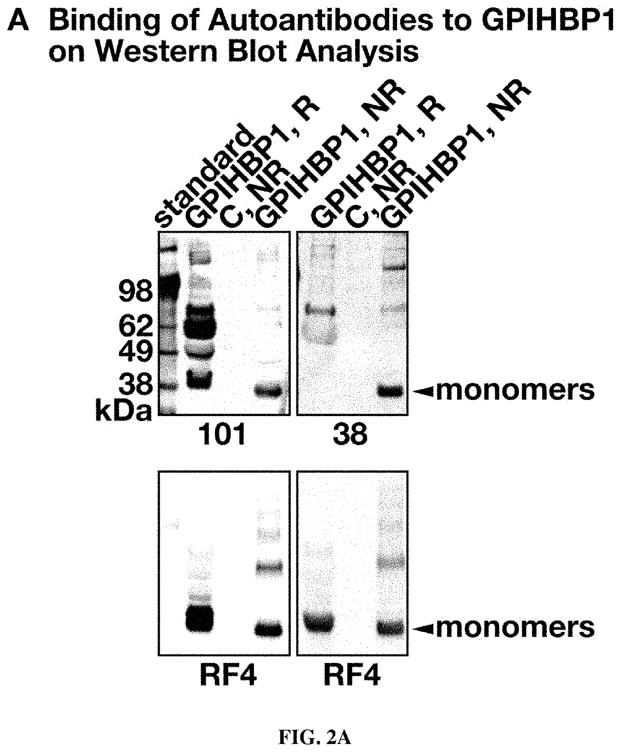 Methods and compositions for treating hypertriglyceridemia