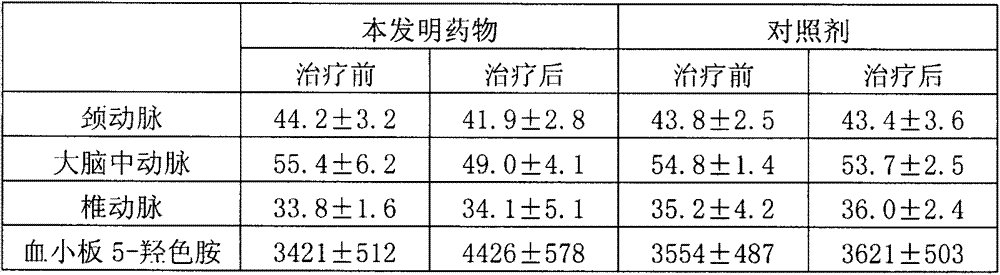 Traditional Chinese medicine composition for treating migraine