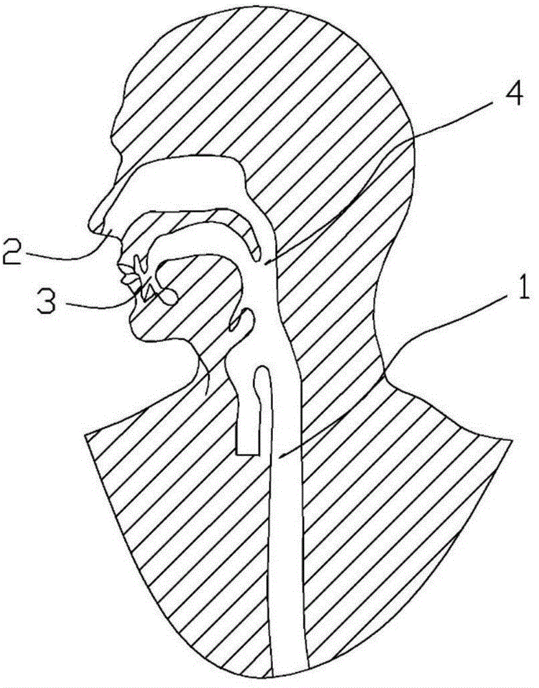 Anti-displacement esophageal stent apparatus bag