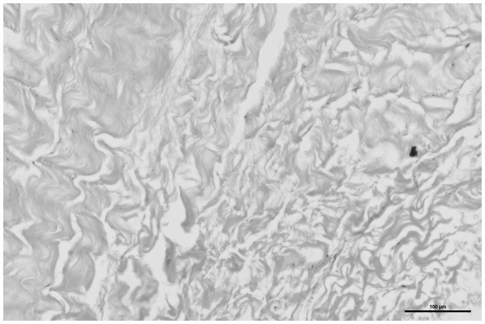 Reagent combination and method for improving calcification resistance of bovine pericardial valve material