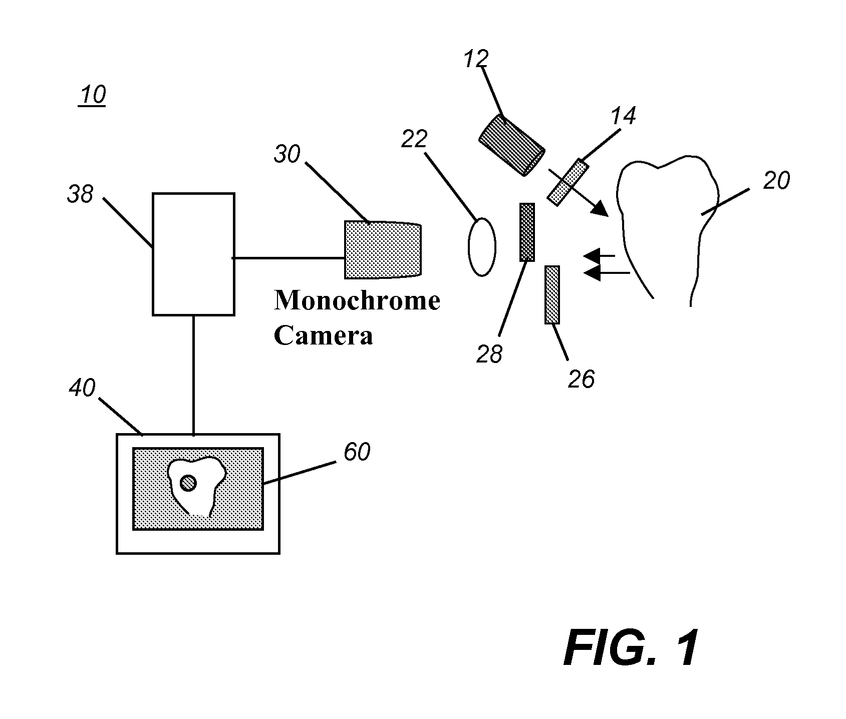 Apparatus for caries detection