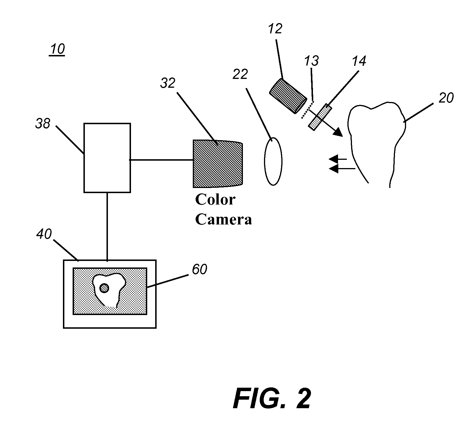 Apparatus for caries detection