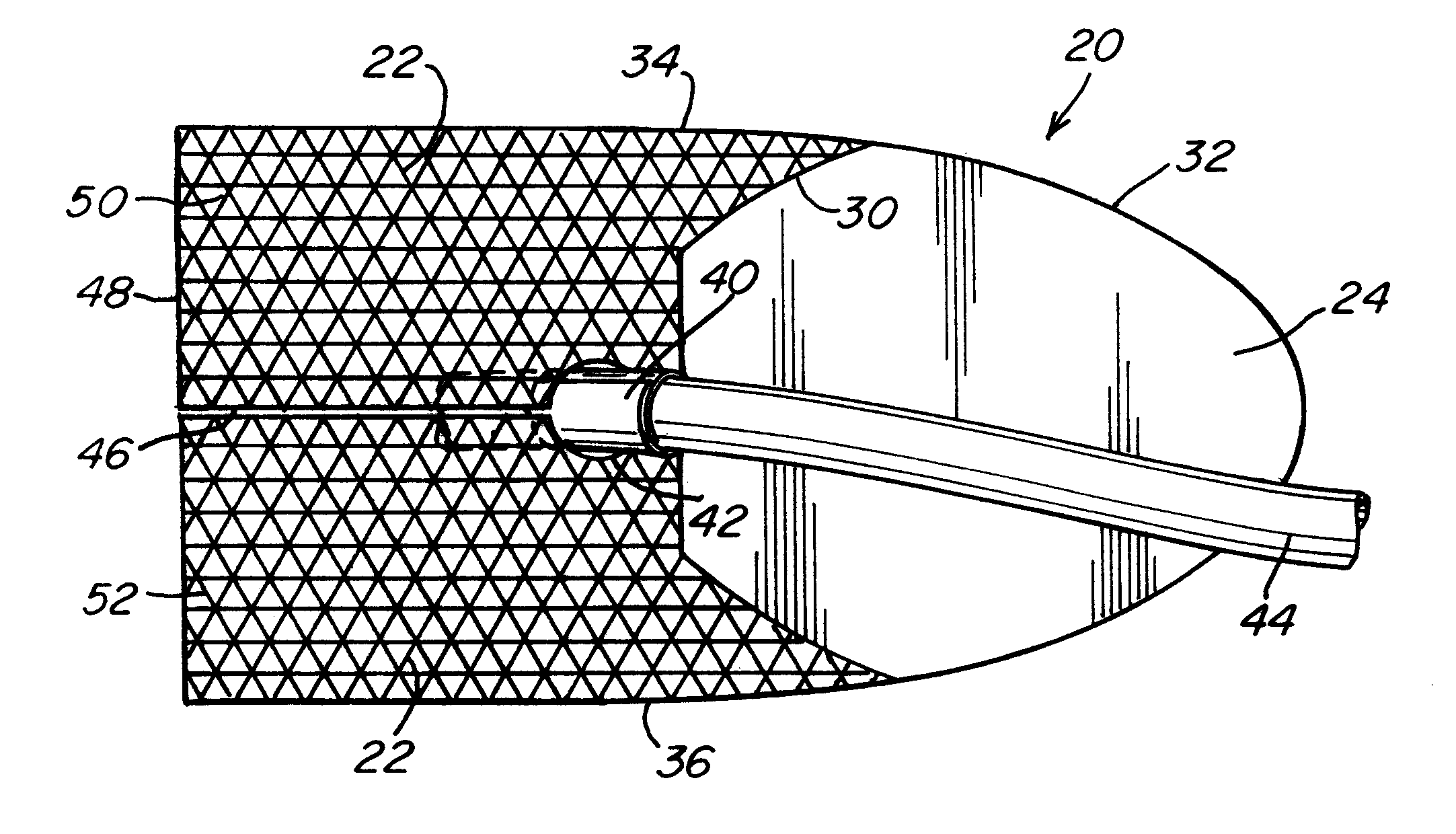 Prosthetic repair fabric