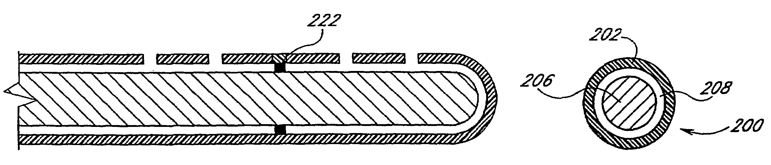 Anti-microbial catheter