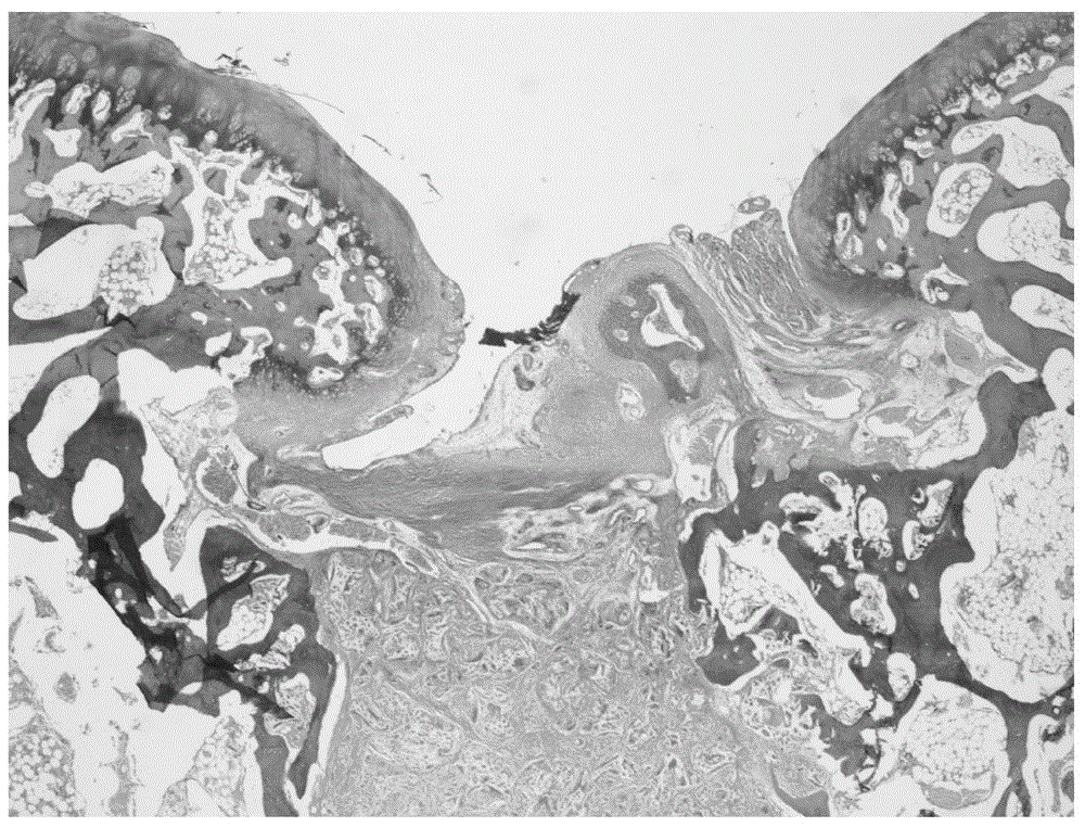 Porous support for cartilage tissue engineering and preparation method thereof