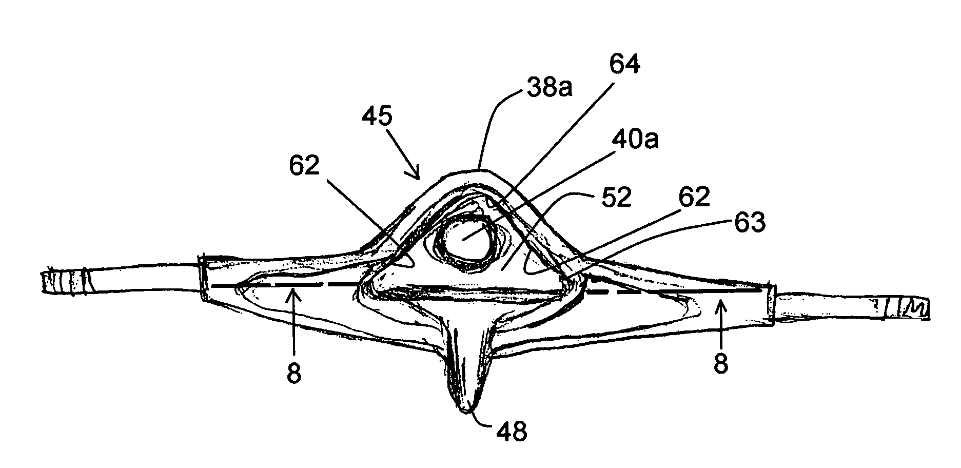 Skateboard wheel truck assembly