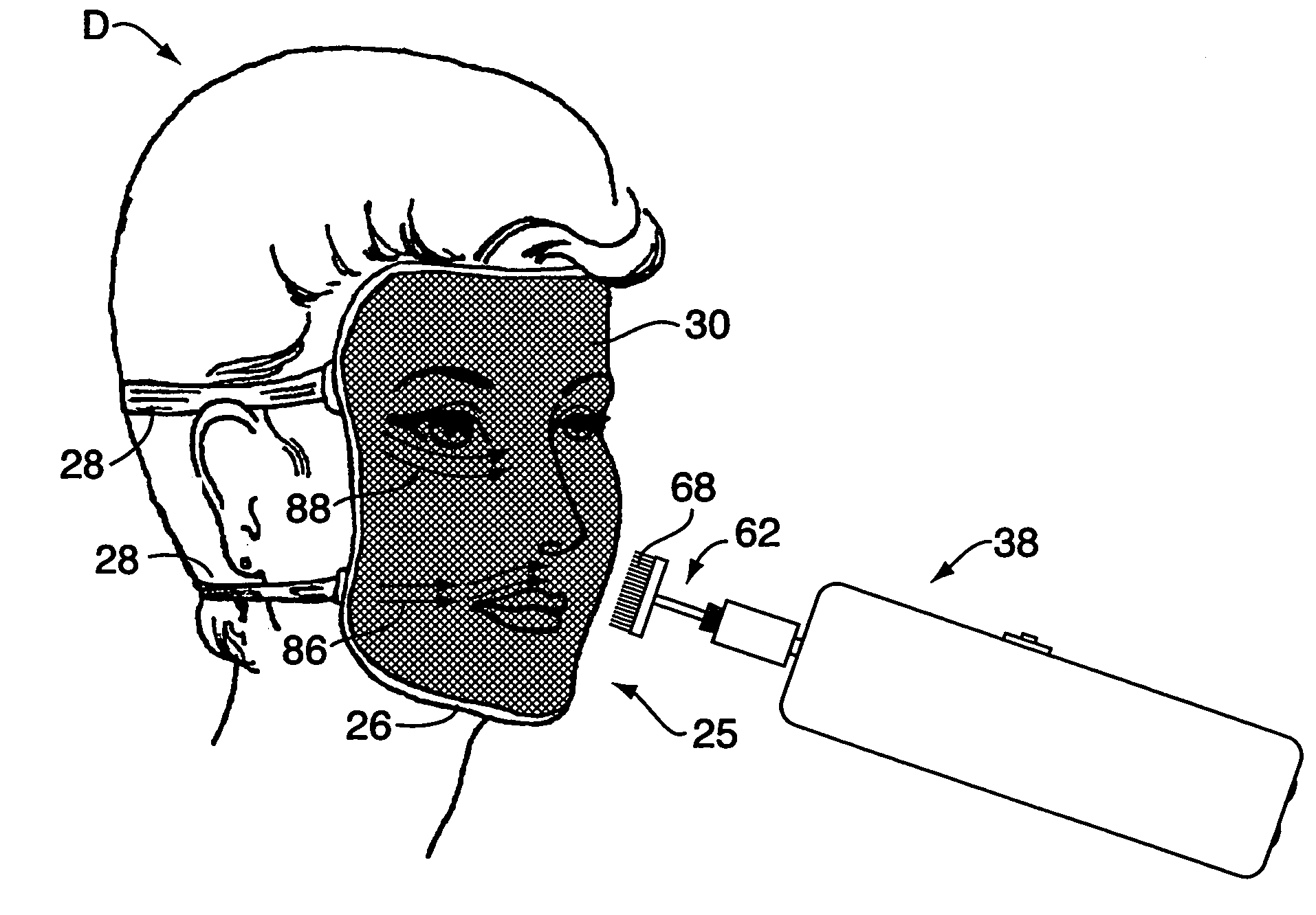 Method and apparatus for training facial muscles to reduce wrinkles