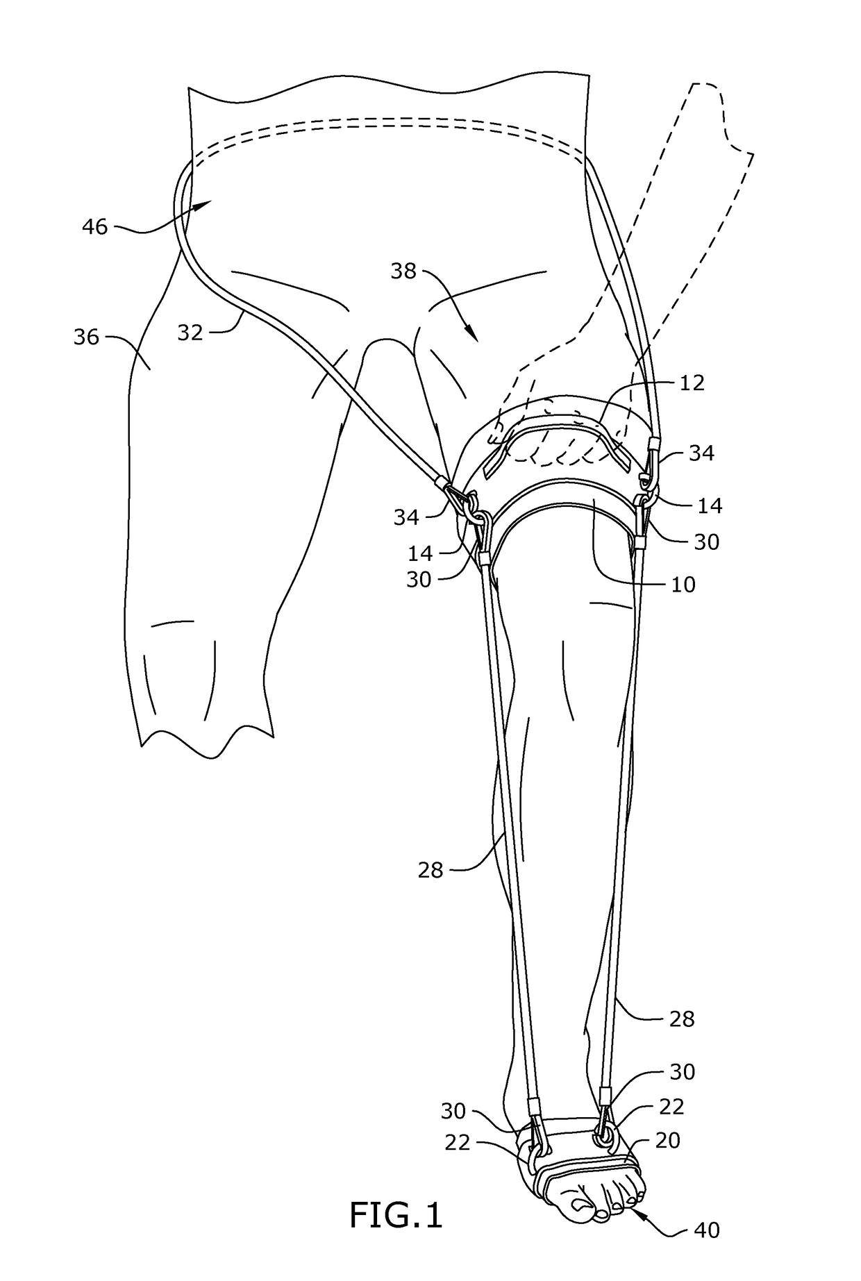 Plantar fasciitis treatment method and device