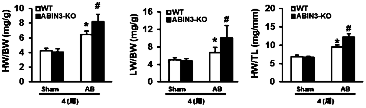 Function and application of A20-binding nuclear factor inhibitory protein 3 (abin3) in the treatment of cardiac hypertrophy