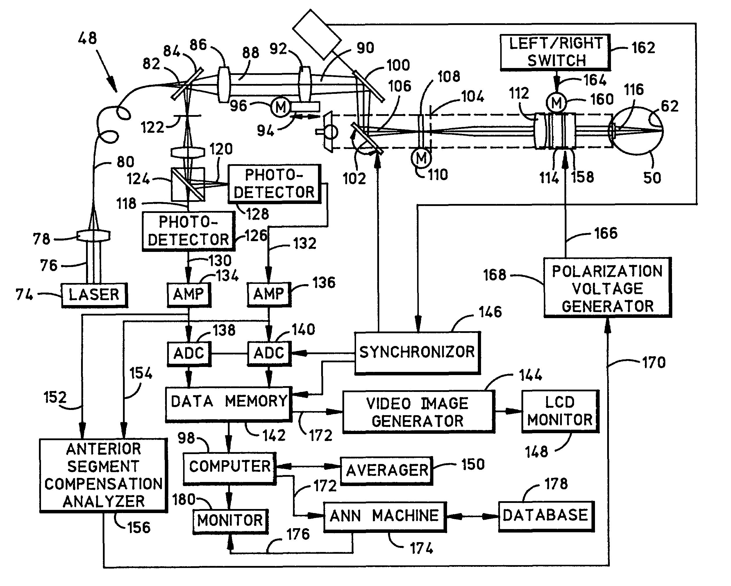 Method and system for detecting the effects of Alzheimer's disease in the human retina