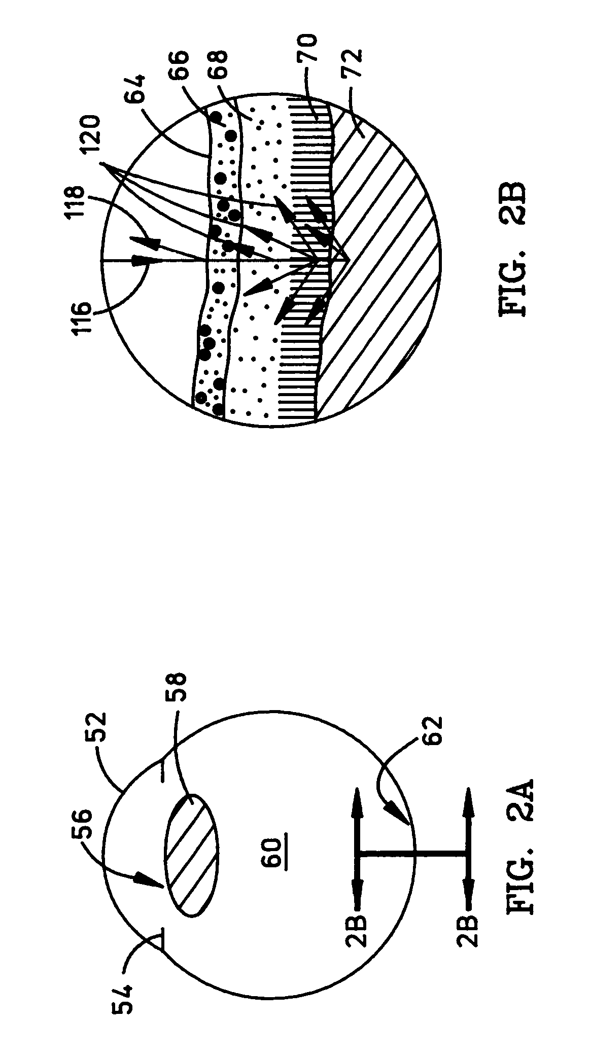 Method and system for detecting the effects of Alzheimer's disease in the human retina