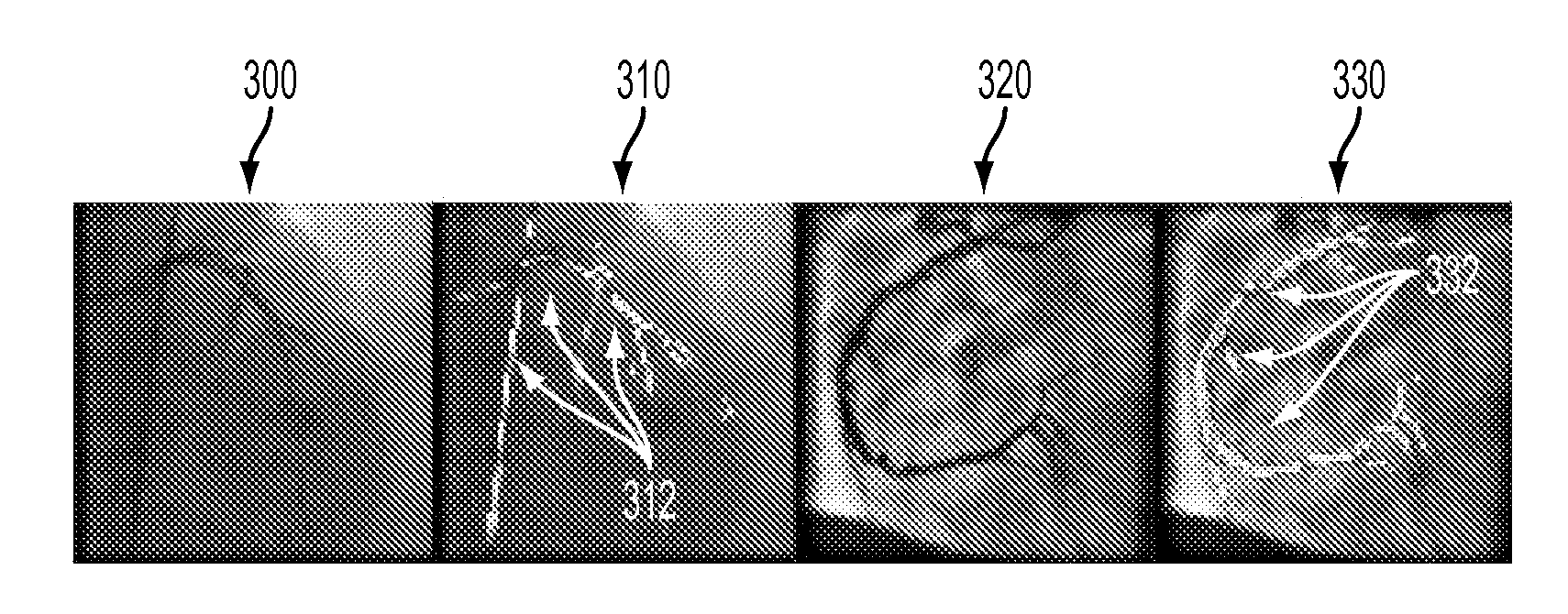 Method and System for Contrast Inflow Detection in 2D Fluoroscopic Images