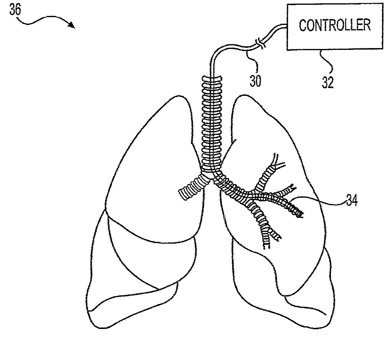 Airway diagnosis and treatment devices and related methods of use