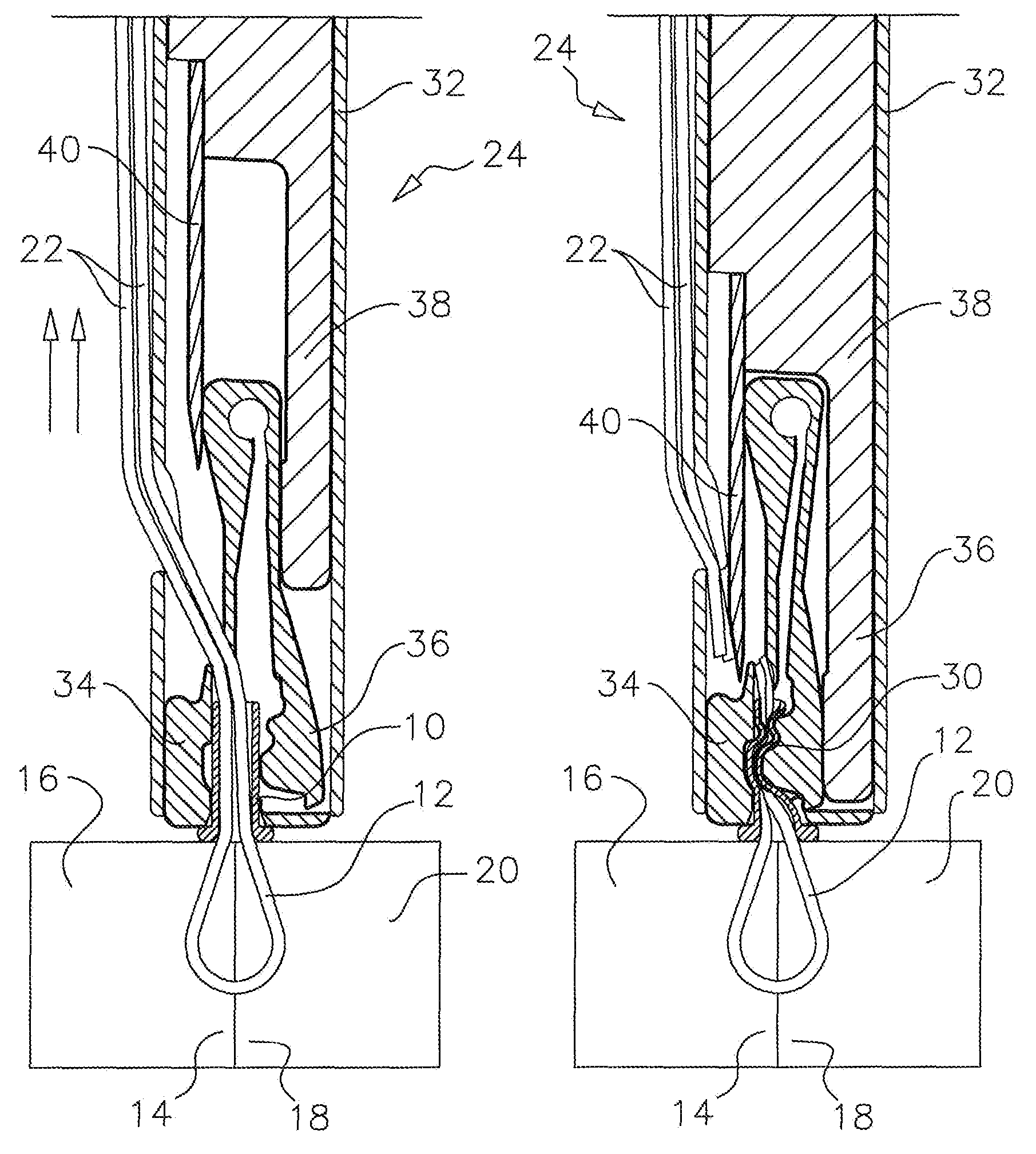 Bioabsorbable magnesium knots for securing surgical suture