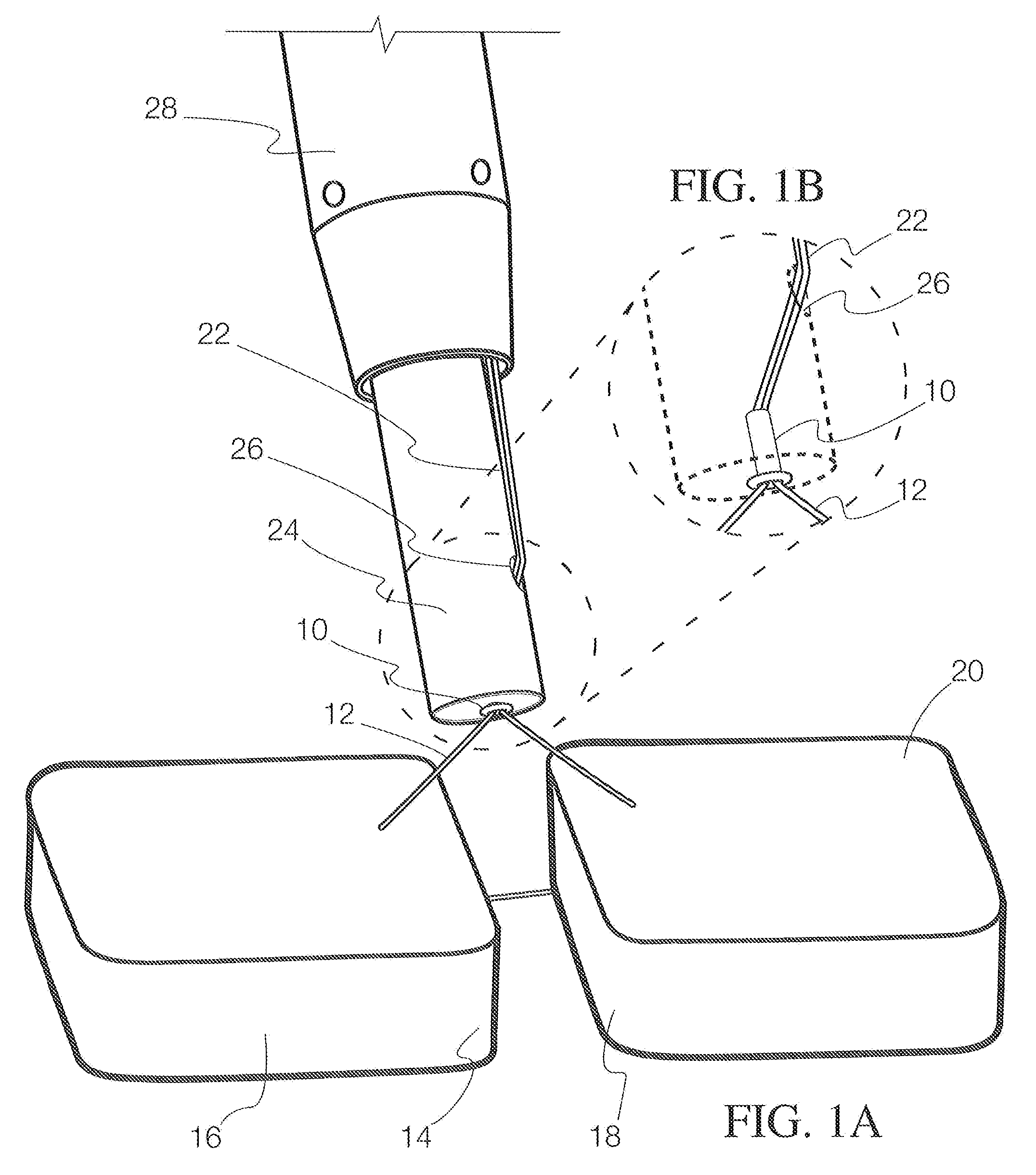 Bioabsorbable magnesium knots for securing surgical suture