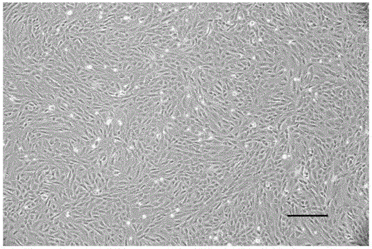 Method for separating and purifying mouse lung microvascular endothelial cell