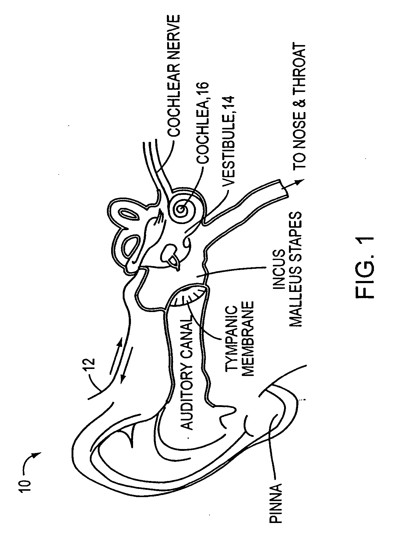 Drug delivery apparatus