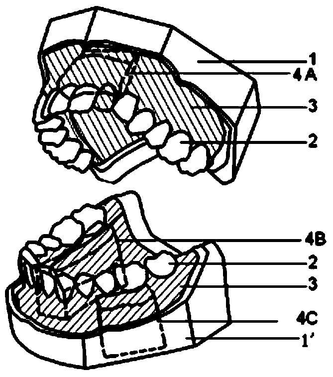 Periodontal operation teaching model