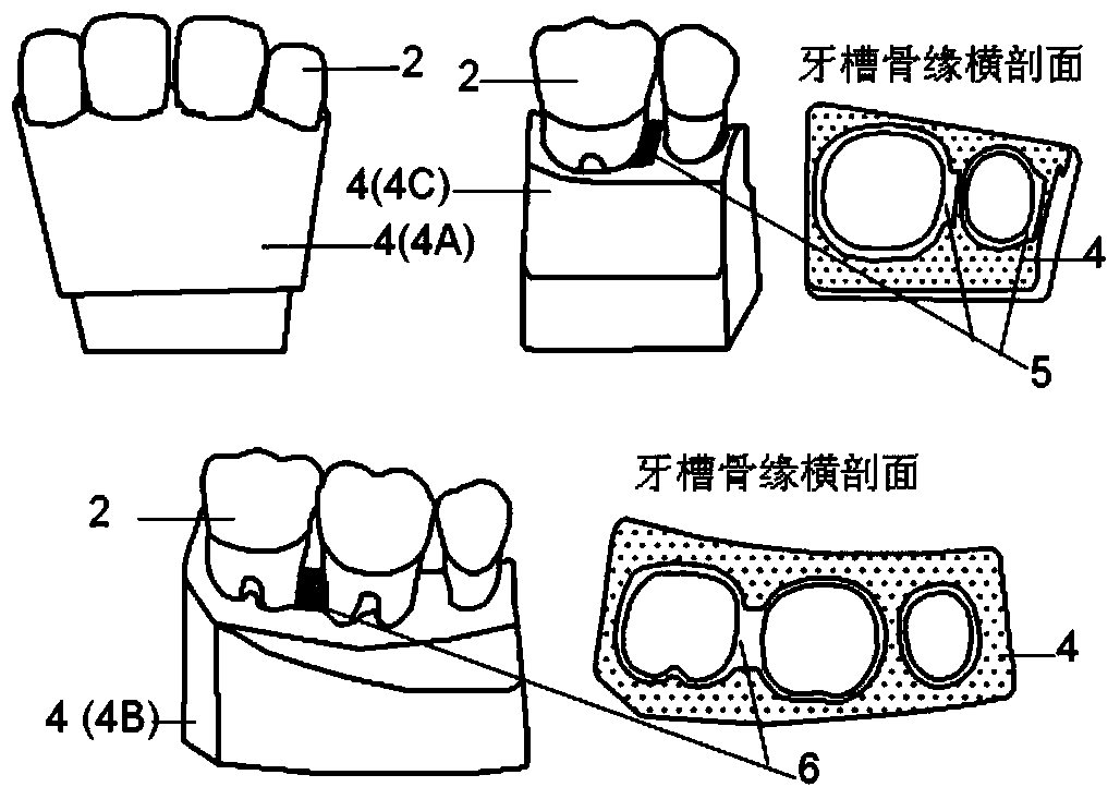 Periodontal operation teaching model