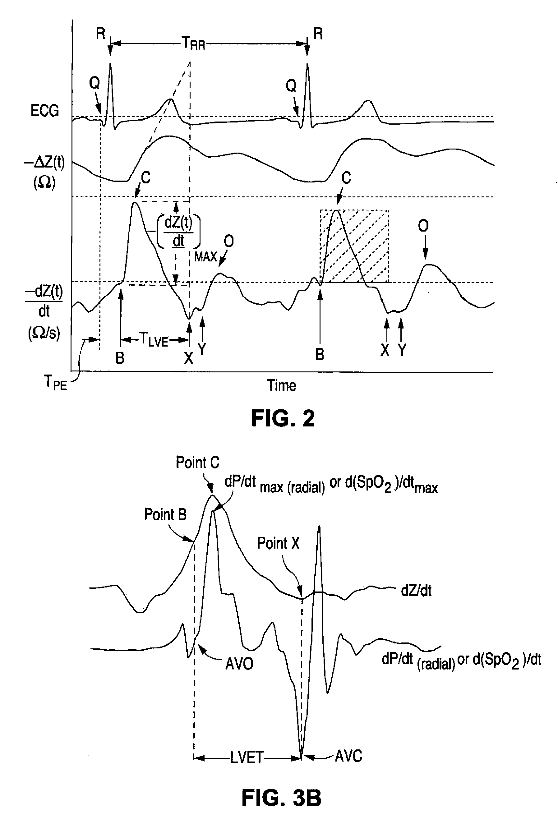 Apparatus And Method For Determination Of Stroke Volume Using The Brachial Artery